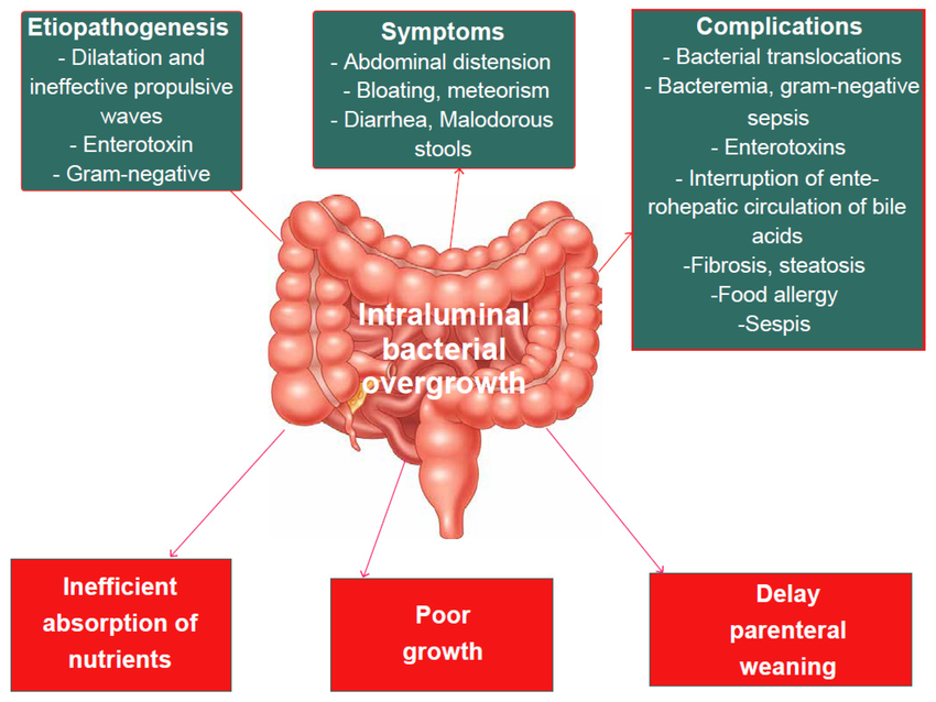 Illustration of gut bacteria overgrowth affecting hormones